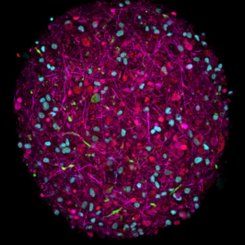 Scientists unveil plan to create biocomputers powered by human brain cells 