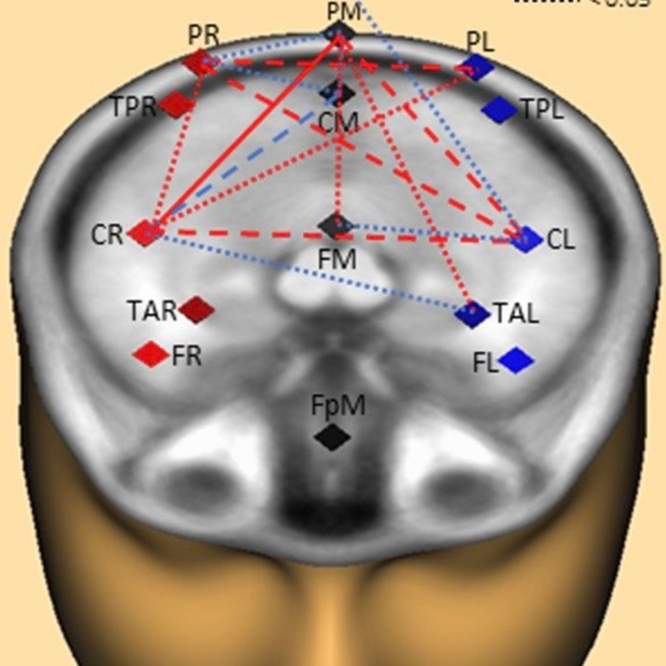 Writing by hand leads to higher brain connectivity than typing on a keyboard 
