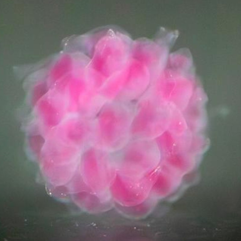 Organs printed on demand