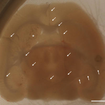 Freezing mouse brain slices brings hope for future brain preservation
