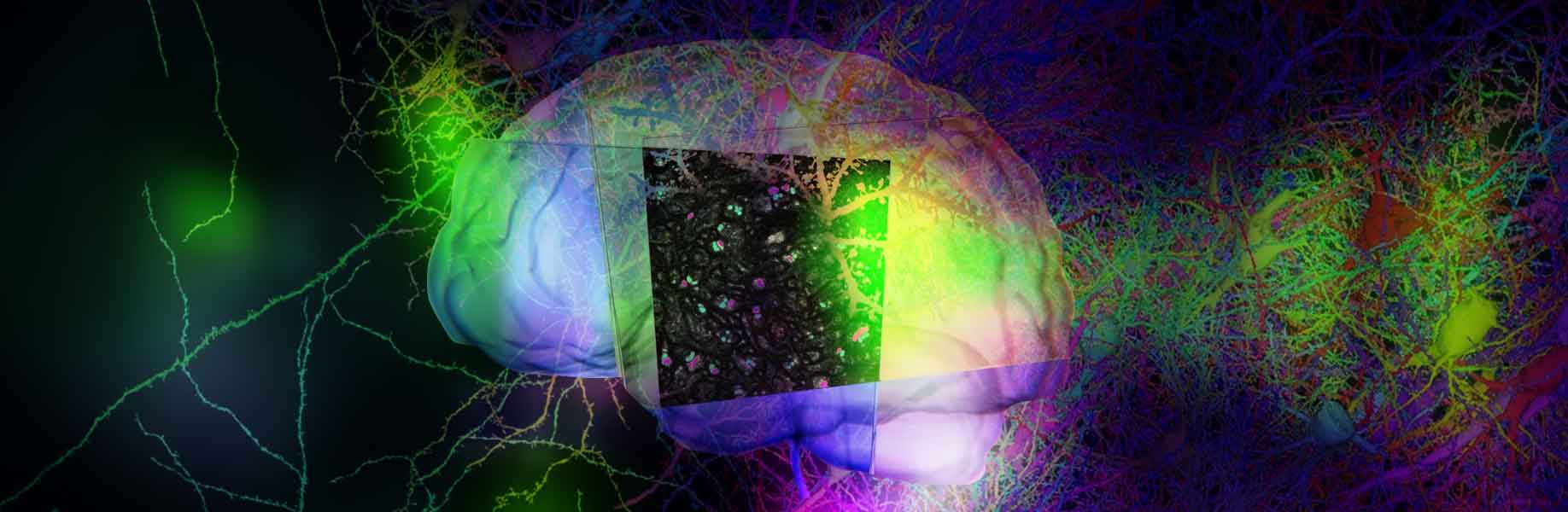 LICONN: A new way to see the brain