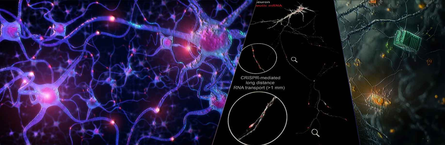 New technology helps repair damaged neurons with RNA