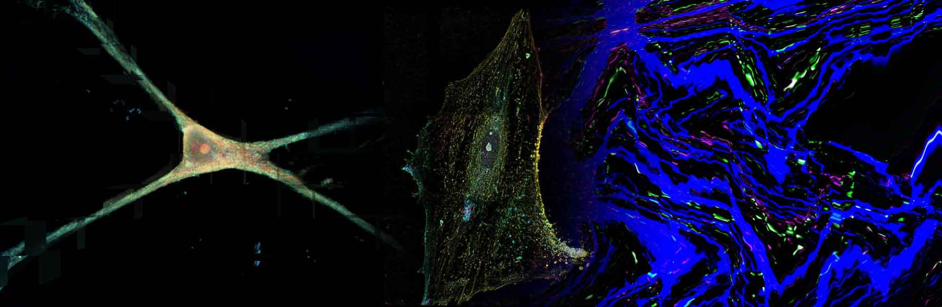 Nanotech platform allows scientists to study star-shaped brain cells in their natural form