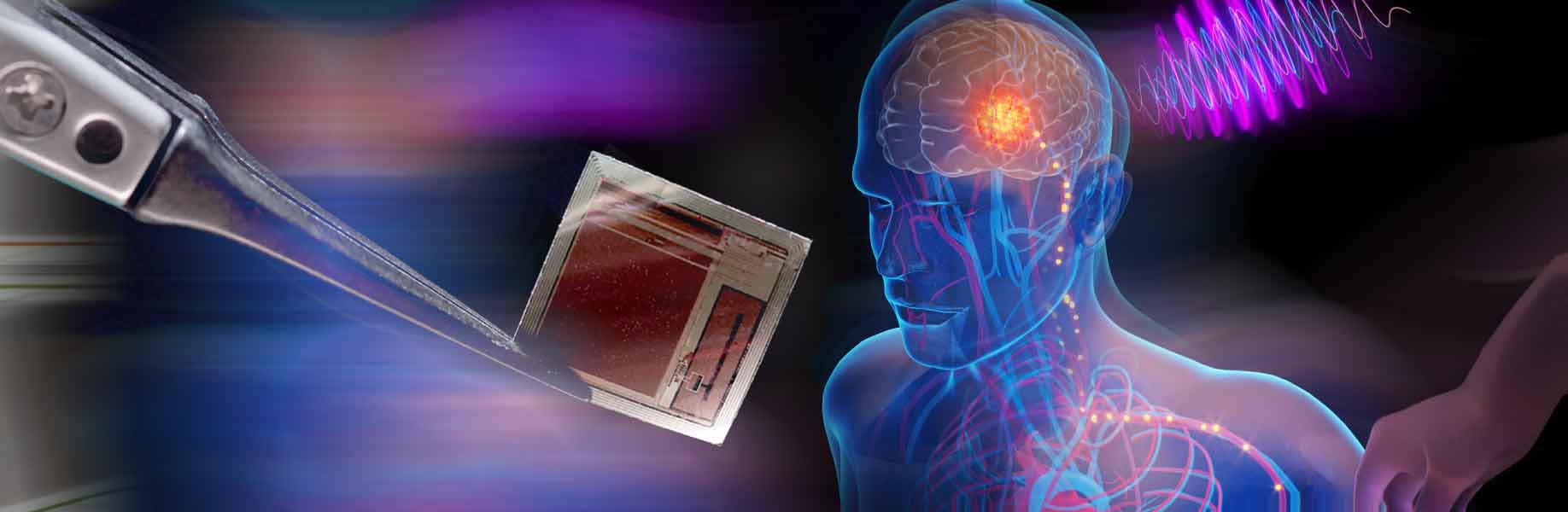 New wireless brain implant offers high-speed connection for treating neurological disorders