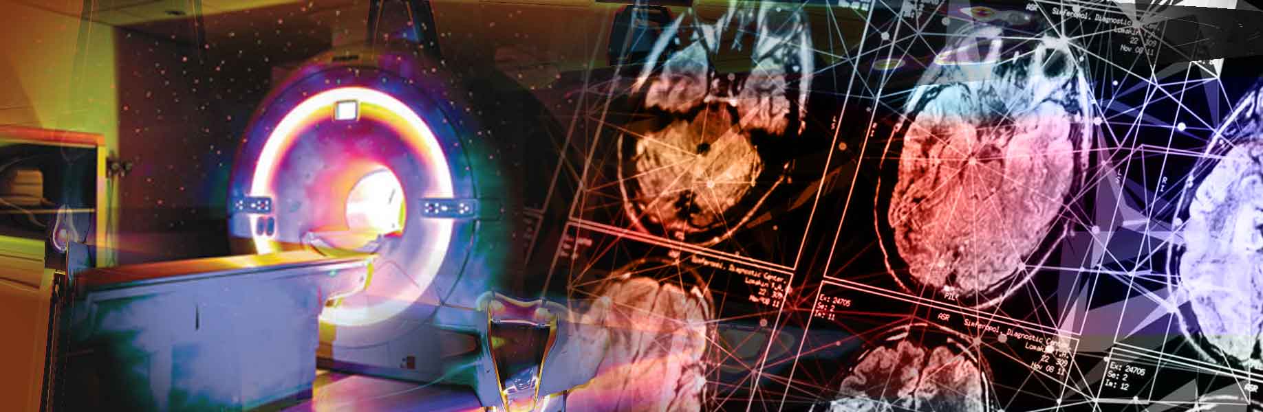 Individual Brain Charting project releases major update of detailed brain scan data