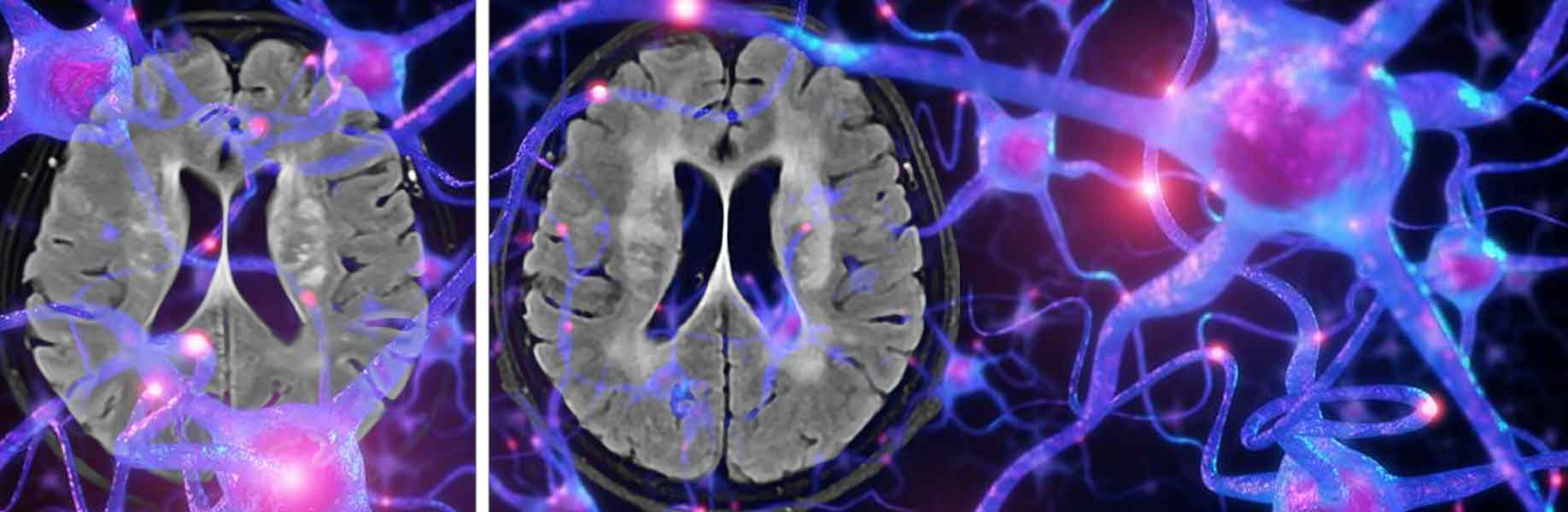 Whole-brain study reveals how worms follow or avoid smells
