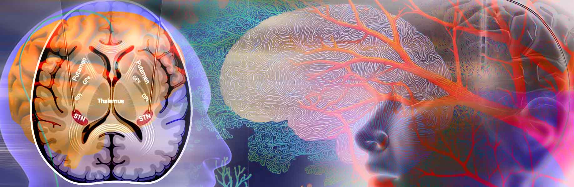 Study shows deep brain stimulation can reshape brain white matter pathways