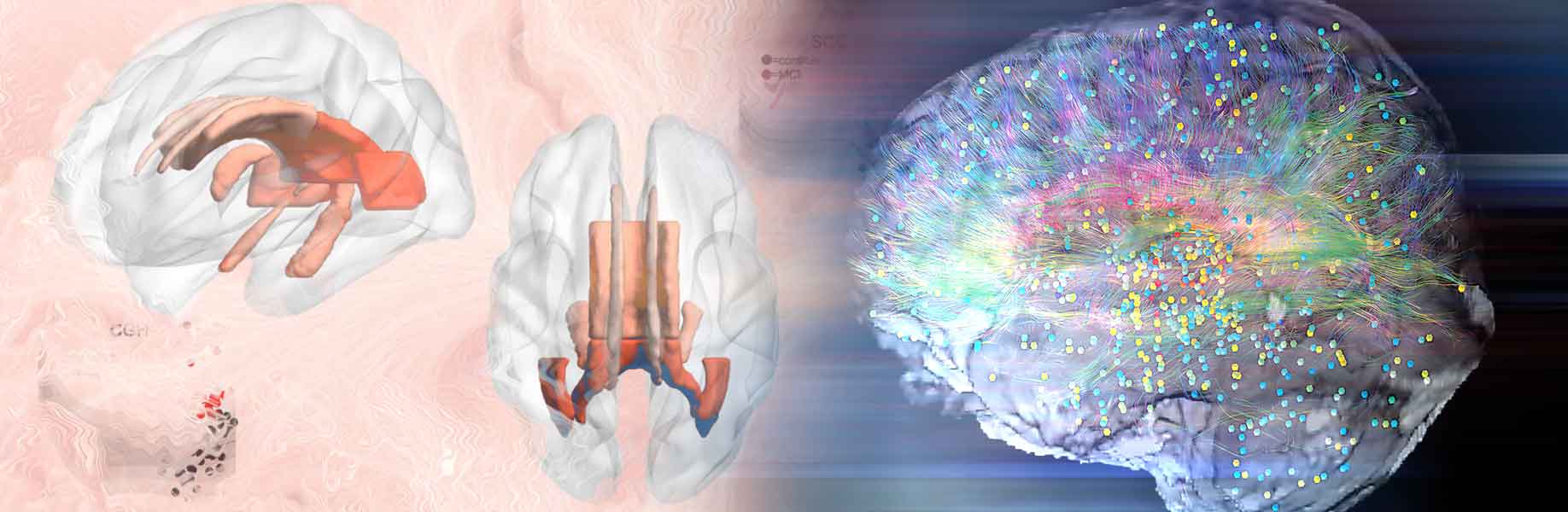 New Reference Map of the Brain May Transform How Scientists Detect Disease