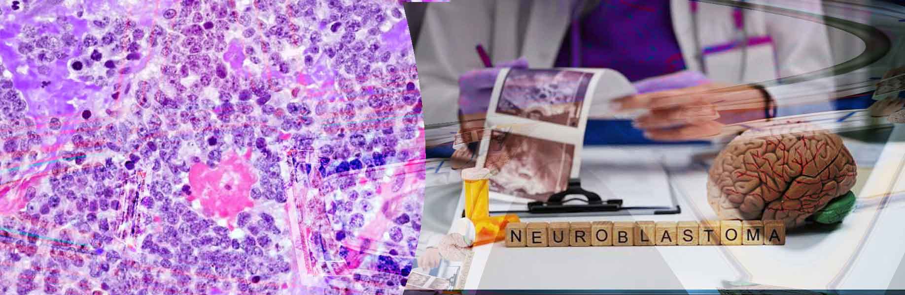 Quantum approach helps predict outcomes for young cancer patients