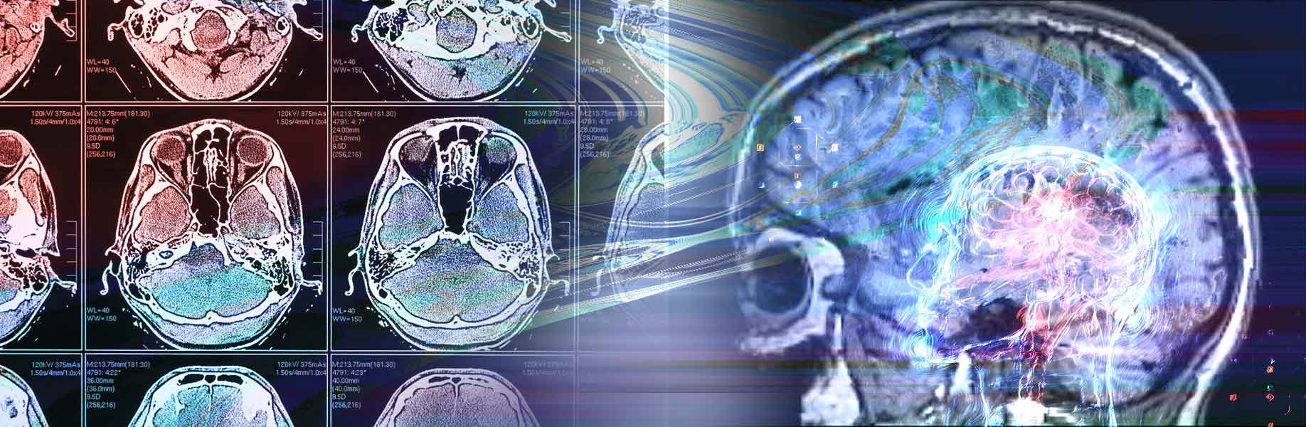 Multimodal AI Predicts Complications After Brain Tumor Surgery