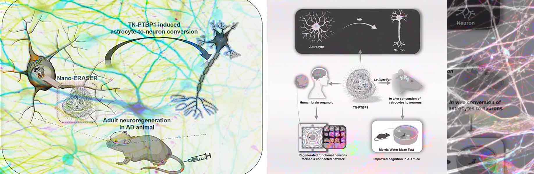 Nanoparticles help new neurons form in Alzheimer’s models